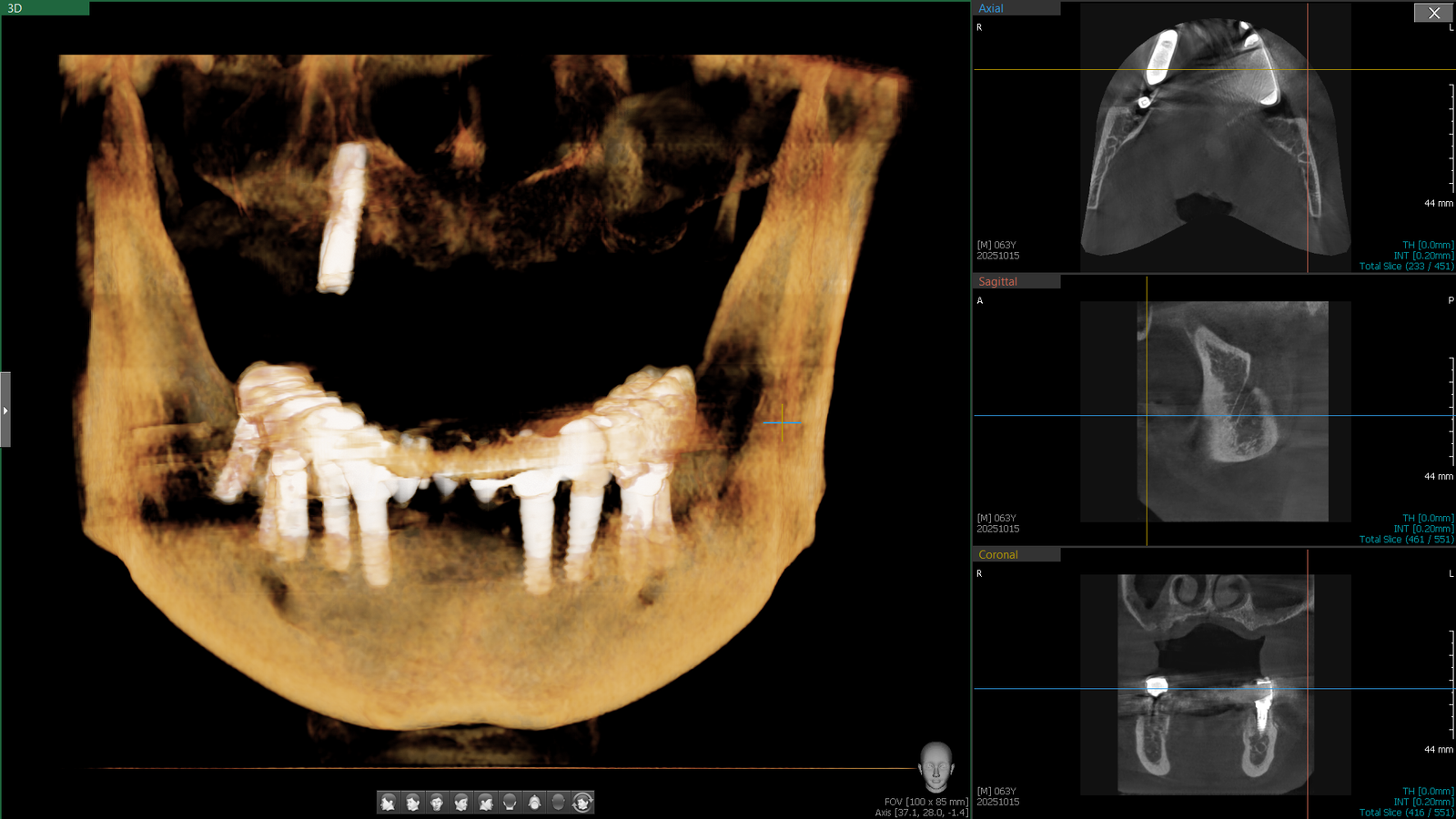 Before - Rafi Ben David