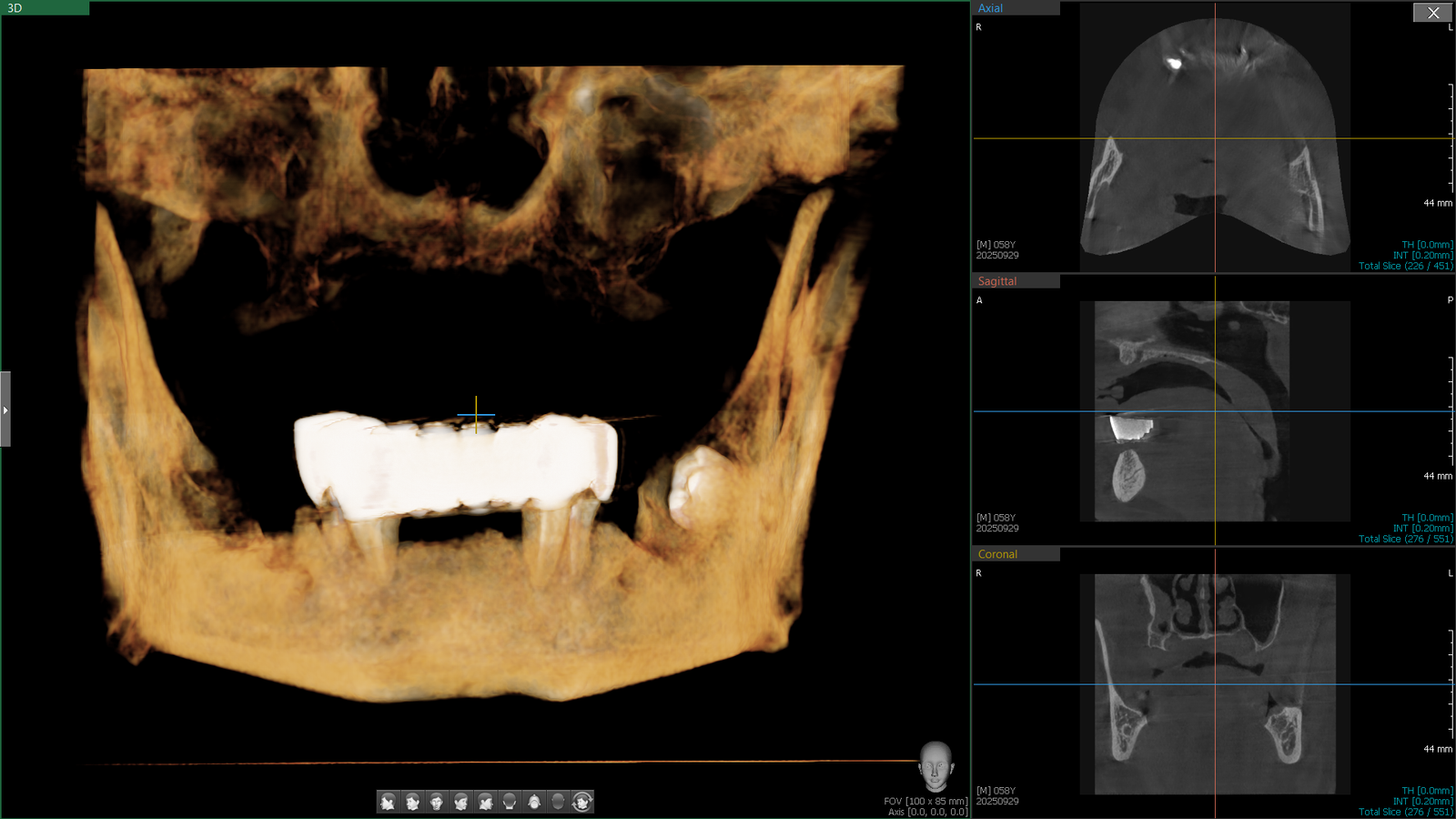 Before - Haim Gutman